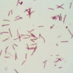 カンピロバクター菌